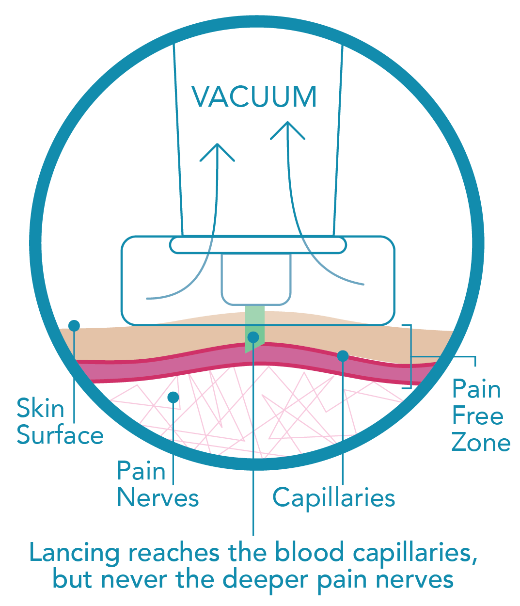 Genteel Lancing Device