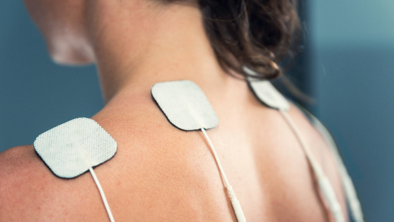Close-up of a person’s upper back and shoulder with three adhesive electrode pads attached, connected to wires, likely for electrical therapy or pain relief treatment.